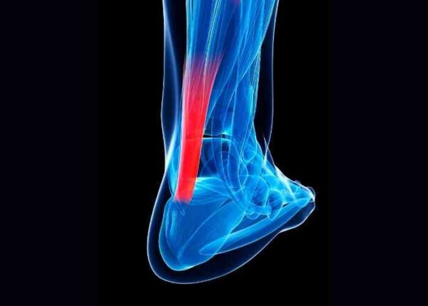 mri of a torn tendon foot