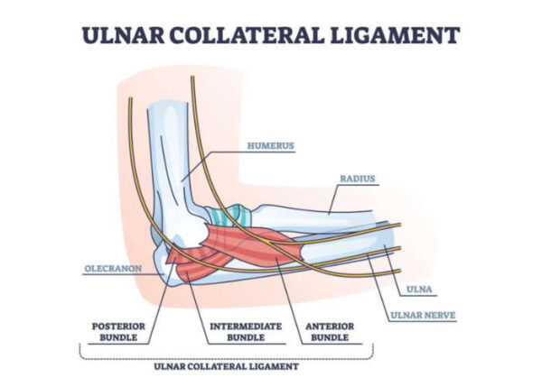 Medial Ulnar Collateral Ligament Tear, UCL Elbow Specialist